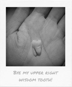 20161022-upper-right-wisdom-tooth